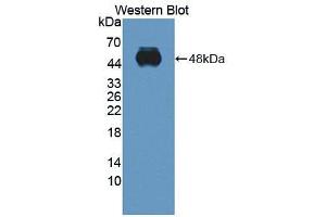 Western blot analysis of the recombinant protein. (ITGA2 Antikörper  (AA 212-370))
