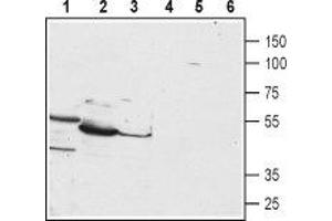 Western blot analysis of HepG2 (lanes 1 and 4), mouse liver (lanes 2 and 5) and rat liver (lanes 3 and 6) lysates: - 1-3. (PTH1R Antikörper  (1st Extracellular Loop))