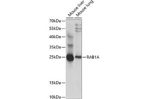 Western blot analysis of extracts of various cell lines, using RA antibody (ABIN7269797) at 1:1000 dilution. (RAB1A Antikörper  (AA 1-100))