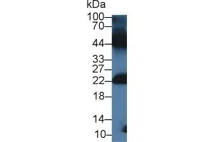Detection of GREM1 in Mouse Testis lysate using Polyclonal Antibody to Gremlin 1 (GREM1) (GREM1 Antikörper  (AA 27-184))