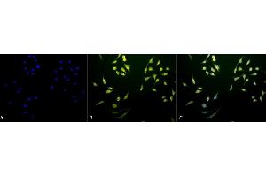 Immunocytochemistry/Immunofluorescence analysis using Rabbit Anti-p70 S6K Polyclonal Antibody (ABIN361700).