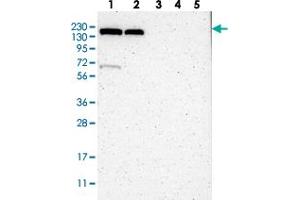 Western blot analysis of Lane 1: RT-4, Lane 2: U-251 MG, Lane 3: Human Plasma, Lane 4: Liver, Lane 5: Tonsil with KIAA0355 polyclonal antibody  at 1:250-1:500 dilution. (KIAA0355 Antikörper)