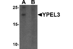 Western blot analysis of YPEL3 in A-20 cell lysate with YPEL3 antibody at 1 µg/mL in (A) the absence and (B) the presence of blocking peptide (YPEL3 Antikörper  (N-Term))