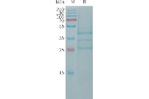 Human Protein, hFc Tag on SDS-PAGE under reducing condition.