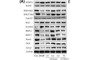 Effect of LWDH on KDM7A, Wnt1/β-catenin signaling, and osteoblast differentiation-related proteins expression of the femur tissue in DNOP rats(A and B) Western blot analysis for KDM7A, H3K9-Me2, H3K27-Me2, Wnt1, β-catenin, BMP-4, BMP-7, Runx2, OCN, and Col1a1 expression in the femur tissue of DNOP rats.