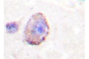 Immunohistochemistry analyzes of PLC β3 antibody in paraffin-embedded human brain tissue. (PLCB3 Antikörper)