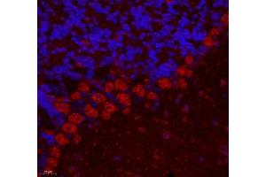 Immunofluorescence of paraffin embedded mouse cerebellum using ZNF295 (ABIN7076264) at dilution of 1: 650 (400x lens) (ZNF295 Antikörper)