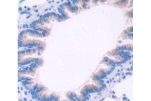 Figure. (CTLA4 Antikörper  (AA 41-192))
