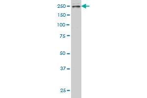 TLN1 monoclonal antibody (M03), clone 1A11. (TLN1 Antikörper  (AA 1052-1149))