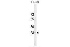 METTL10 Antibody (N-term) western blot analysis in HL-60 cell line lysates (35µg/lane). (METTL10 Antikörper  (N-Term))