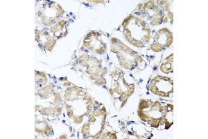 Immunohistochemistry of paraffin-embedded human stomach using MGAT1 antibody (ABIN5975025) at dilution of 1/100 (40x lens). (MGAT1 Antikörper)