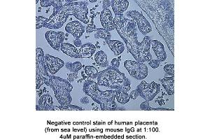 Image no. 2 for anti-Hypoxia Inducible Factor 1, alpha Subunit (Basic Helix-Loop-Helix Transcription Factor) (HIF1A) (AA 329-530) antibody (ABIN363210) (HIF1A Antikörper  (AA 329-530))