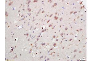 Formalin-fixed and paraffin embedded rat brain labeled with Rabbit Anti-ANKRD9 Polyclonal Antibody, Unconjugated (ABIN2170251) at 1:200 followed by conjugation to the secondary antibody and DAB staining (ANKRD9 Antikörper  (AA 21-200))