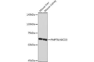 Western blot analysis of extracts of various cell lines, using PMP70/ Rabbit mAb (ABIN1683181, ABIN3018647, ABIN3018648 and ABIN7101638) at 1:1000 dilution. (CX3CL1 Antikörper)