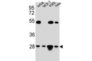 Western Blotting (WB) image for anti-Transcription Factor A, Mitochondrial (TFAM) antibody (ABIN5015230) (TFAM Antikörper)