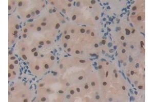 Immunohistochemistry (IHC) image for anti-Hepatoma-Derived Growth Factor (HDGF) (AA 10-240) antibody (ABIN7432232)