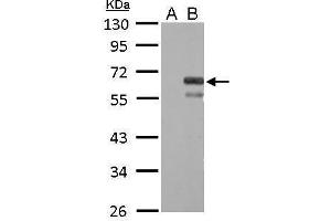 WB Image Factor X antibody detects F10 protein by Western blot analysis. (Coagulation Factor X Antikörper)