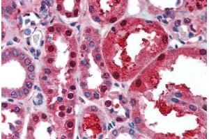 Immunohistochemistry (Paraffin-embedded Sections) (IHC (p)) image for anti-Transcription Factor 21 (TCF21) (AA 42-91) antibody (ABIN462190)