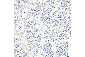 Immunohistochemistry of paraffin-embedded human appendix using FKBP5 antibody.