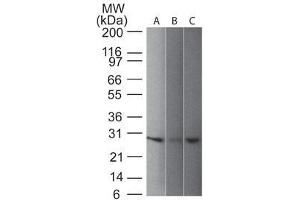 Western blot of UchL1 (PGP9.