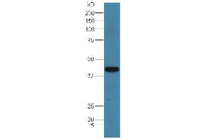 Lane 1:mouse spleen lysate probed with Rabbit Anti-Adenosine deaminase Polyclonal Antibody, Unconjugated  at 1:5000 for 90 min at 37˚C.