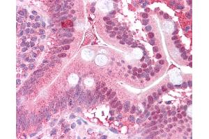 Immunohistochemistry (IHC) image for anti-Mitogen-Activated Protein Kinase Kinase 2 (MAP2K2) (N-Term) antibody (ABIN2783572) (MEK2 Antikörper  (N-Term))