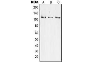 Western blot analysis of JIK expression in HeLa (A), Jurkat (B), HEK293 (C) whole cell lysates. (TAO Kinase 3 Antikörper  (Center))