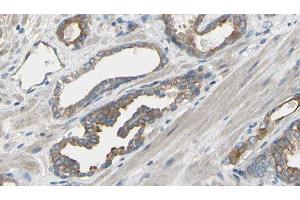 ABIN6277567 at 1/100 staining Human prostate tissue by IHC-P. (EIF4B Antikörper  (Internal Region))