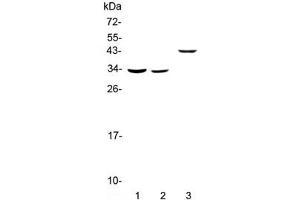 Western blot testing of 1) rat liver, 2) mouse liver and 3) human SMMC-7721 lysate with Regucalcin antibody at 0. (Regucalcin Antikörper)
