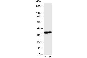 Western blot testing of Kallikrein 9 antibody and Lane 1:  MCF-7;  2: A431 cell lysate