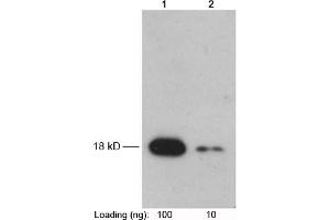 Lane 1-2: Recombinant Trx-tag fusion protein in E. (Trx Tag Antikörper)