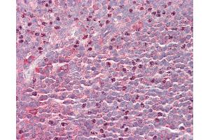 anti-Septin 6 (SEPT6) (AA 523-534) antibody