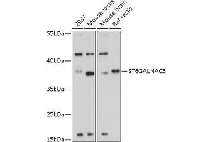 Western blot analysis of extracts of various cell lines, using ST6G antibody (ABIN7270580) at 1:1000 dilution. (ST6GALNAC5 Antikörper  (AA 28-336))