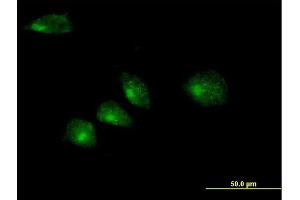 Immunofluorescence of purified MaxPab antibody to GOSR2 on HeLa cell.