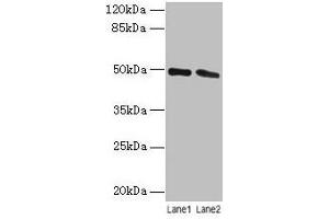 Western blot All lanes: STAMBP antibody at 12 μg/mL Lane 1: Jurkat whole cell lysate Lane 2: Hela whole cell lysate Secondary Goat polyclonal to rabbit IgG at 1/10000 dilution Predicted band size: 49, 40 kDa Observed band size: 49 kDa (STAMBP Antikörper  (AA 1-424))