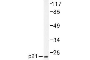 Image no. 1 for anti-Cyclin-Dependent Kinase Inhibitor 1A (p21, Cip1) (CDKN1A) antibody (ABIN271762) (p21 Antikörper)