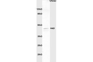Lane 1: human colon carcinoma lysates probed with Anti phospho-ERK1/2(Thr202 + Tyr204) Polyclonal Antibody, Unconjugated (ABIN682933) at 1:200 in 4 °C. (ERK1/2 Antikörper  (pThr202, pTyr204))