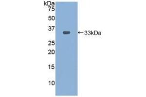 Detection of Recombinant PDXK, Mouse using Polyclonal Antibody to Pyridoxal Kinase (PDXK) (PDXK Antikörper  (AA 29-285))