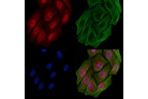 ABIN6258197 and ABIN6273942 staining Hela cells by IF/ICC. (GPR88 Antikörper  (Internal Region))