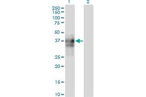 Western Blot analysis of SPARC expression in transfected 293T cell line by SPARC monoclonal antibody (M04A), clone 1A2. (SPARC Antikörper  (AA 1-303))