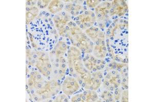 Immunohistochemistry of paraffin-embedded mouse kidney using SULT1A1 antibody (ABIN5970776) at dilution of 1/100 (40x lens). (SULT1A1 Antikörper)