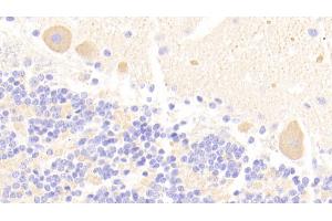 Detection of CHRNa3 in Human Cerebellum Tissue using Polyclonal Antibody to Cholinergic Receptor, Nicotinic, Alpha 3 (CHRNa3) (CHRNA3 Antikörper  (AA 32-240))