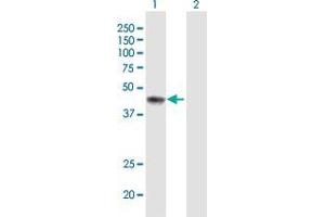 Western Blot analysis of ERCC8 expression in transfected 293T cell line by ERCC8 MaxPab polyclonal antibody. (ERCC8 Antikörper  (AA 1-396))
