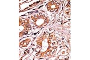 Image no. 2 for anti-Retinoblastoma 1 (RB1) (pSer249) antibody (ABIN358210) (Retinoblastoma 1 Antikörper  (pSer249))