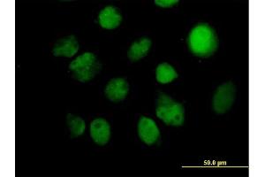 Immunofluorescence of purified MaxPab antibody to ITPK1 on HeLa cell. (ITPK1 Antikörper  (AA 1-314))