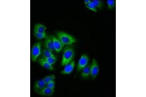 Immunofluorescence staining of HepG2 cells with ABIN7157699 at 1:200, counter-stained with DAPI. (KRIT1 Antikörper  (AA 471-585))