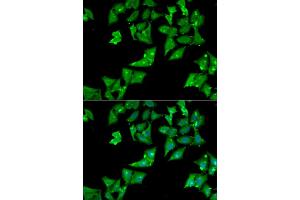 Immunofluorescence analysis of HeLa cells using AGA antibody (ABIN6294189). (AGA Antikörper)