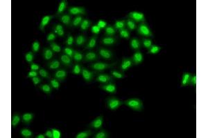 Immunofluorescence analysis of  cells using PHF11 antibody (ABIN6128437, ABIN6145533, ABIN6145535 and ABIN6217420). (PHF11 Antikörper  (AA 1-292))