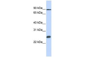 WB Suggested Anti-RBPMS Antibody Titration:  0. (RBPMS Antikörper  (Middle Region))