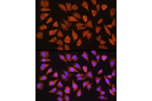 Immunofluorescence analysis of L929 cells using IMPDH1 Rabbit pAb (ABIN6133190, ABIN6142433, ABIN6142434 and ABIN6225023) at dilution of 1:100 (40x lens). (IMPDH1 Antikörper  (AA 434-563))